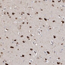 SLC10A4 Antibody, Novus Biologicals 25 &mu;L; Unlabeled:Antibodies, Polyclonal